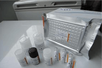 人肾母细胞瘤蛋白1（WT1）酶联免疫分析（ELISA）